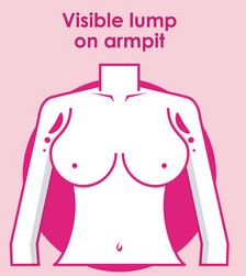 lump-in-armpit